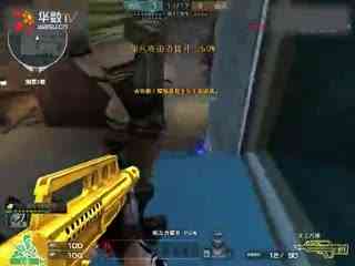 iG名宿秃子多？ rookie ：因为遗传的M型发型已植发